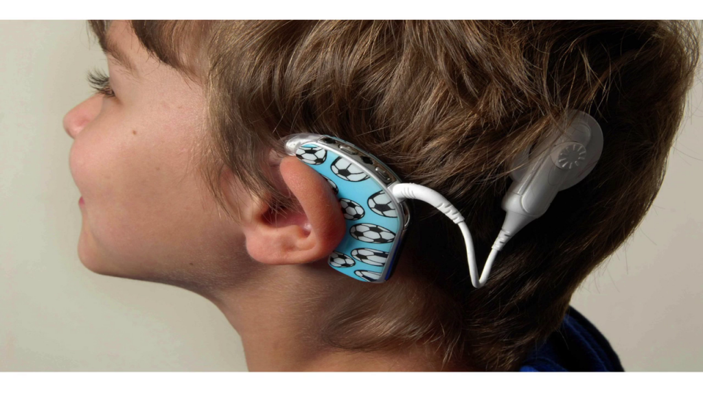 Photo of the side of a child's head, with his cochlear implant in view.