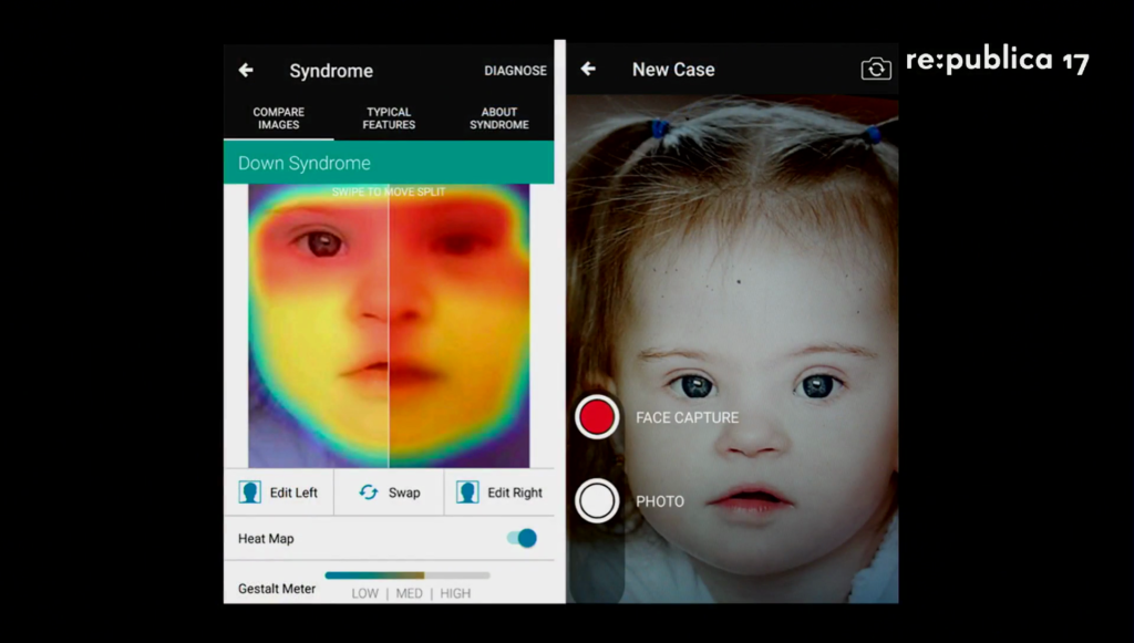 Screenshot of an application scanning a child's face to diagnose Down Syndrome.
