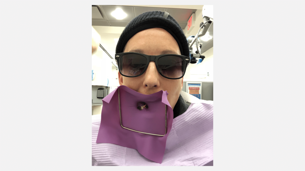 Close-up of Liz's face with a metal apparatus holding a square of latex over and in her mouth to isolate a tooth.